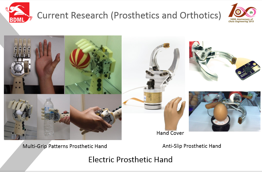 Current Research (Prosthetics and Orthotics)